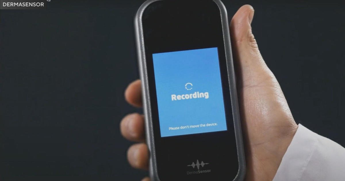 New AI Tool DermaSensor to Detect Skin Cancer 1 New AI Tool DermaSensor to Detect Skin Cancer